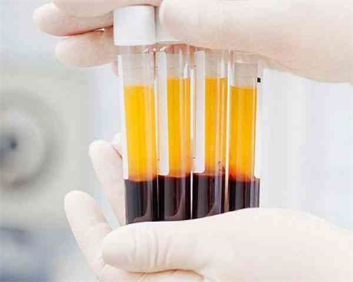 第三代试管费用_第四代试管哪里可以做_俄罗斯试管周期前饮食要注意什么？