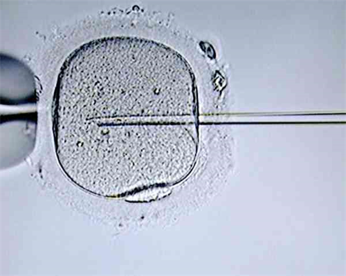 三代试管的步骤和时间_试管婴儿价格_多囊能做试管吗？多囊做试管能成功吗