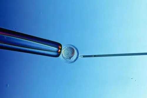 试管婴儿移植后注意事项_试管婴儿的孩子的好处_试管婴儿移植前注意事项及饮