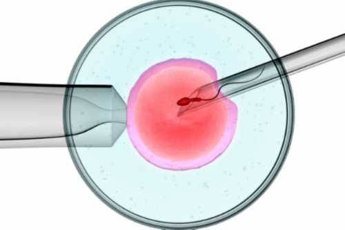 国内试管可以选择性别_试管龙凤胎费用多少钱_您需要了解的生长激素知识在这