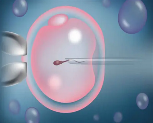 [南京供精试管婴儿离婚怎么判]_241Wj_46P0y_efuG6_两步移植法移植两个胚胎成双胞胎