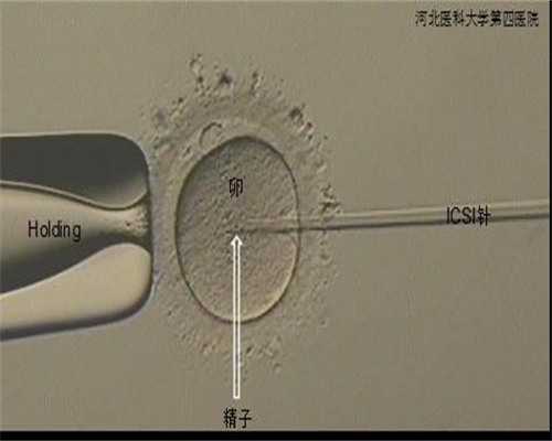 绝经后可以借卵试管吗_美国供卵试管婴儿攻略及费用_山东私立生殖医院养囊成