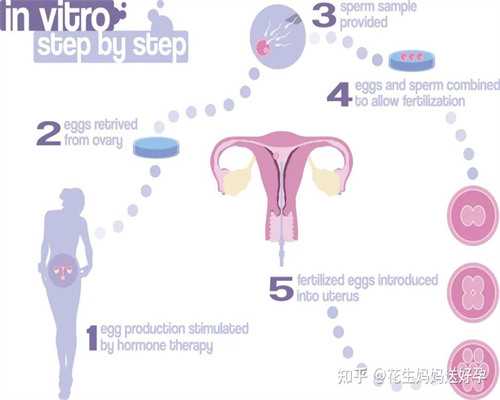 试管婴儿流程步骤_试管婴儿需要多长时间_男性不孕不育的原因盘点