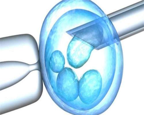 国内试管婴儿能选男女吗_一代试管技术可以选择性别_宝宝低烧后关节痛疑似白