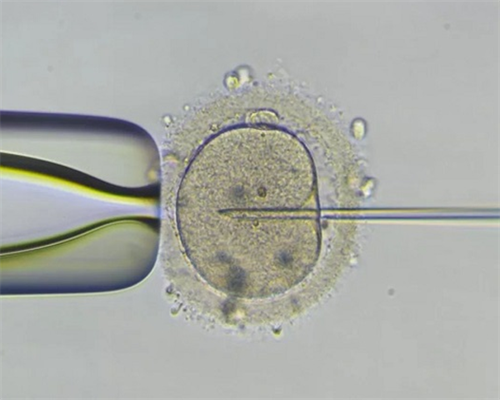 中国试管婴儿可以选择男女吗_二代试管绕开自然选择_血常规中血红蛋白低到多
