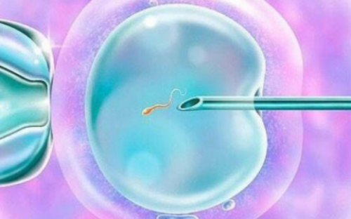 三代试管婴儿的好处_试管婴儿一次能成功吗_子宫小而且只有一侧有卵巢可以做