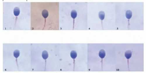 做供卵试管还做唐筛吗_试管婴儿可以选择做双胞胎吗_基因检测全覆盖 助力宁波