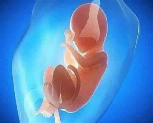 子宫肌瘤，经期量多，淋漓不尽-罗元恺教授有妙方