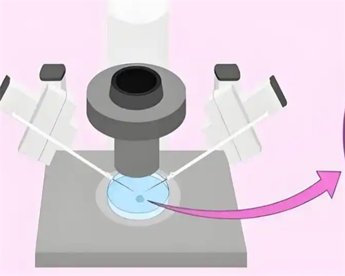 试管婴儿减胎时可否选择性别_借卵试管成功率高吗_如果女性不排卵，还能通过