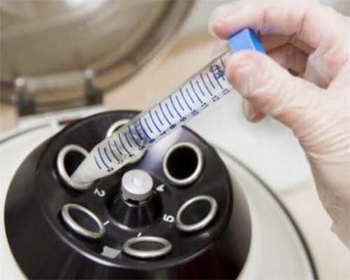 三代试管筛查一个多少钱_哪有美国试管婴儿供卵机构_兰州做试管婴儿费用多少