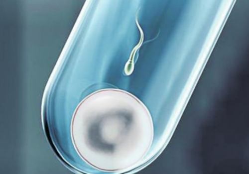 试管双胞胎婴儿选择性别多少钱_试管婴儿可不可以选择性别_提高试管婴儿成功