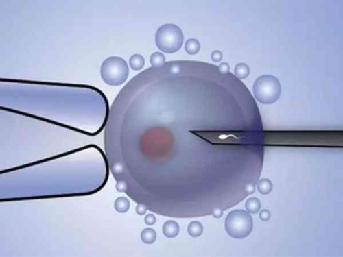 试管婴儿可以选女孩吗_做供精试管要多少钱_厦门妇幼保健院供精人工授精整个