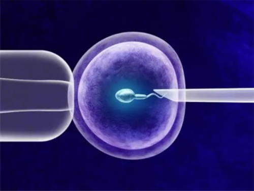 试管选择性别要多少钱_试管会筛选掉畸形精子吗_北京人工受孕哪个医院比较好