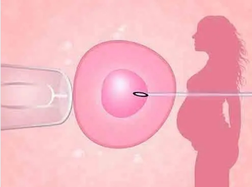 三代试管婴儿_48岁做供卵试管婴儿_45岁还可以做试管婴儿吗?