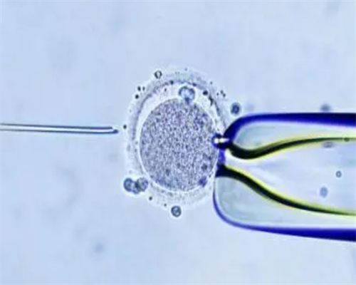 第三代试管婴儿选择性别准吗_青岛做试管可以选男女吗_身体可以正常怀孕但想