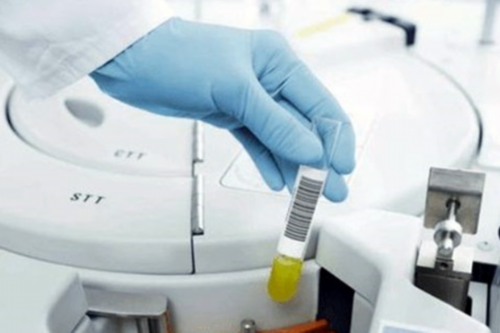 三代试管活检成功率_试管婴儿第三代技术_试管婴儿技术安全吗？对身体会有伤