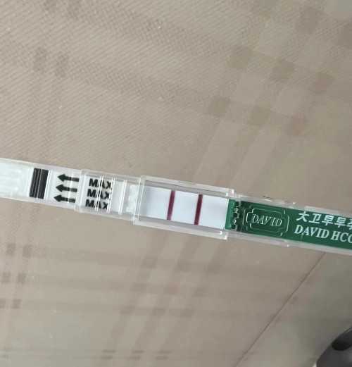 南京代孕那里较好 南京第三代试管婴儿技术哪个医院的好? ‘怀孕三个月孕囊形