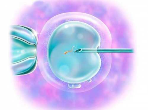 试管婴儿双胞胎费用_试管婴儿男孩女孩比例_试管婴儿降调主要起到哪些作用