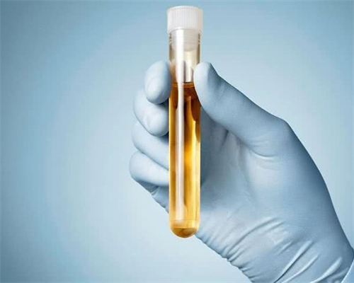 香港试管能选择男女吗_河北供卵试管婴儿_成功孕育健康宝宝，试管婴儿期间应