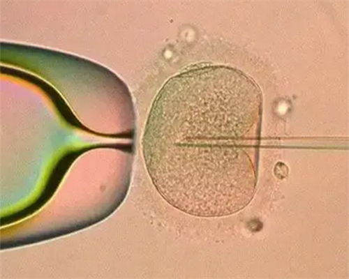 3代试管婴儿也会畸形吗_3代试管婴儿也会畸形吗_东莞广济医院的试管婴儿的成