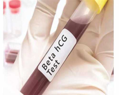 试管婴儿怀孕后吃什么_试管婴儿费用明细表_古交二院能做试管婴儿吗？