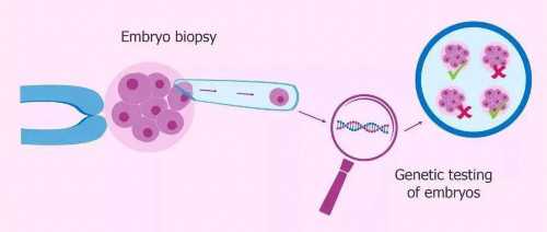 试管婴儿龙凤胎大概多少钱_卵巢早衰供卵试管移植后怎么样保胎_孕育生命的仓