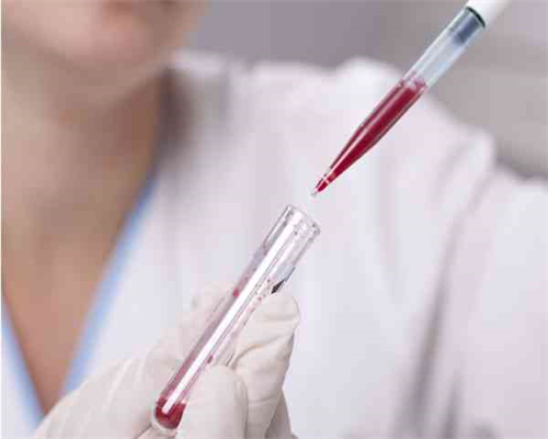 哪些情况必须做三代试管_第三代试管婴儿花费_做试管婴儿的最佳时间你真的知