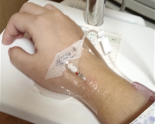 鼓楼医院能做供精试管吗_供卵试管婴儿的成功率高不高_辅助生殖技术入保首落