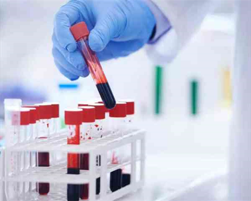 南京3代试管婴儿费用明细 南京妇幼保健院生殖医学中心 ‘九周的孕囊看男女’