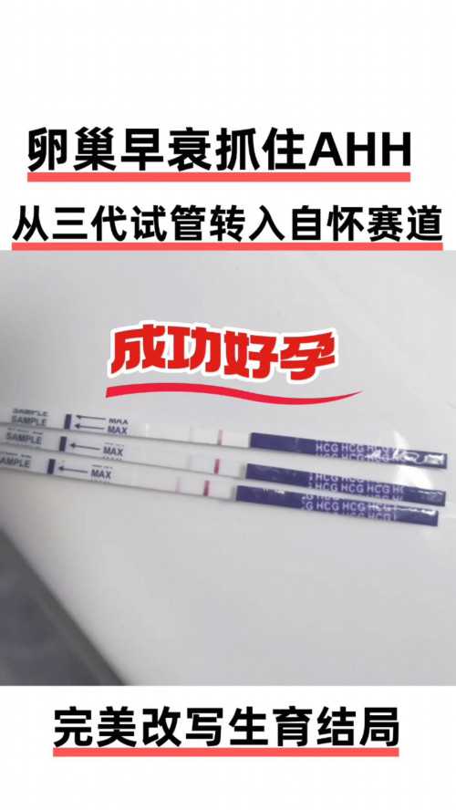 试管婴儿可以选性别不_三代试管精子筛选技术_毓璜顶医院公益直播课第105期：