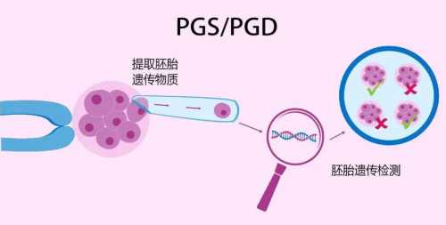 试管婴儿选男多少钱啊_做试管婴儿可以选择龙凤胎吗_普洱有公立医院能做试管