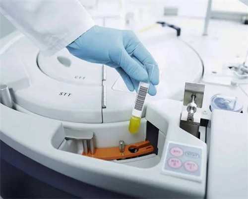 试管婴儿可选择男女吗?_为什么三代试管可以选择性别_1.5毫升精液有多少个精子