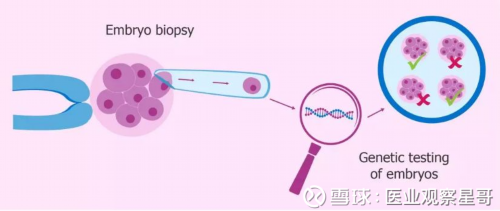 试管性别筛选对胚胎有影响吗_中山二院做试管可以选性别吗_做试管婴儿不能想