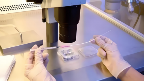 南京代孕要多少钱啊 南京试管婴儿收费是多少? ‘32周双顶径看男女’