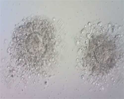 四代试管失败的姐妹_国外做三代试管多少钱_q3EOD_瑞白上午打还是下午打好？