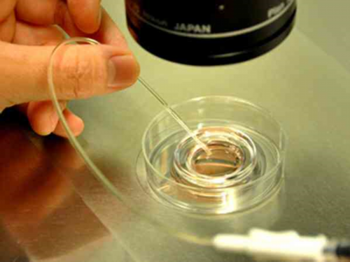 做四代试管婴儿排名_四代试管婴儿泰悦生男女_4WBbQ_D6V1A_白带清洁度3度是怎么回