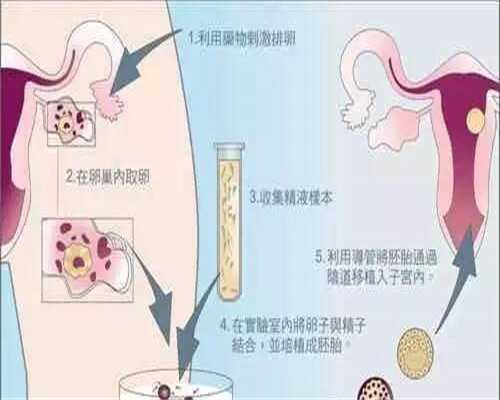 [南京人工试管婴儿那好惟有武汉黄浦擅选]_0O4KC_着床成功排出的白带长啥样？有