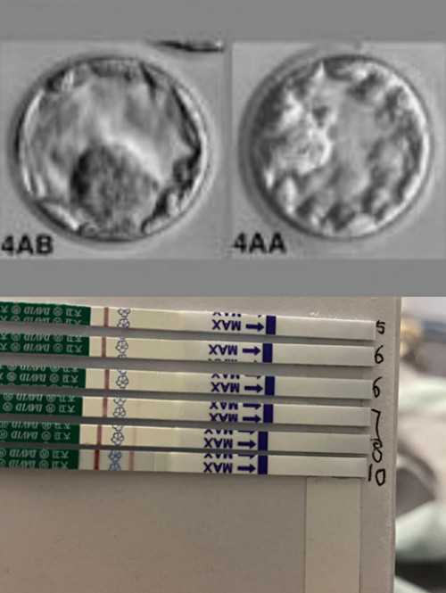 南京哪家代孕较好 三、南京妇幼保健院供精试管婴儿成功率： ‘怀男怀女怎么