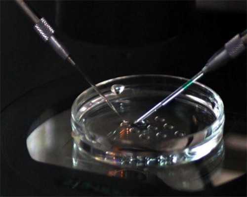 试管婴儿前做哪些检查_试管婴儿过程几个月_黑河能做供卵试管婴儿吗？期望“