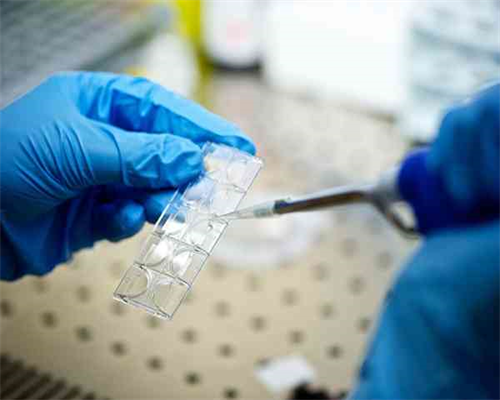 经期总想大便怎么回事