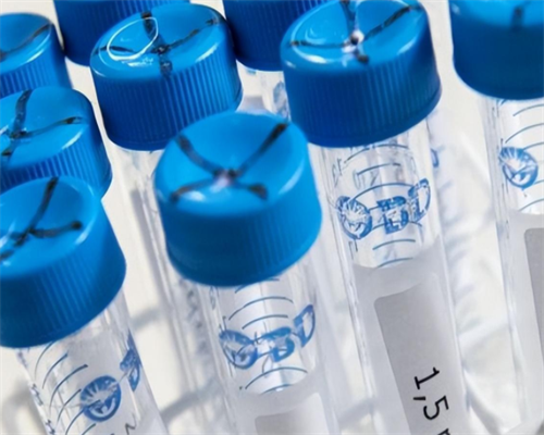 国内供卵试管选男女_试管婴儿可选择男女吗?_海外做试管婴儿的费用是多少？有