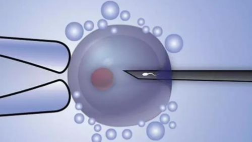 海外试管机构选 培恩国际_供精三代试管多少钱_第五代试管技术有什么最新消息