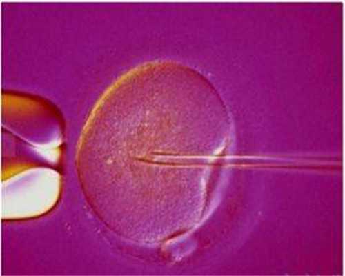 昆明试管婴儿试管哪家好啊？,昆明做试管婴儿哪里好