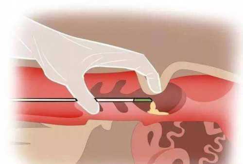 南京代孕全过程 南京试管婴儿费用贵吗?具体要多少钱? ‘怀孕时四维彩超看着