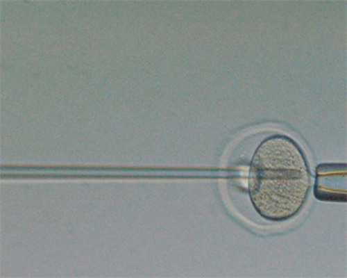 [南京为什么试管很多龙凤胎]_α和β地贫哪个遗传给宝宝后比较严重？_0kM6p_552