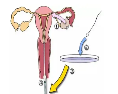 月经期也叫卵泡期吗