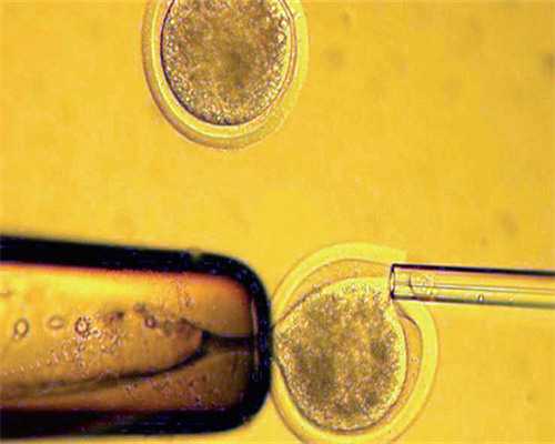 莆田试管婴儿「泰国试管」,莆田九院试管哪个医生好点？?