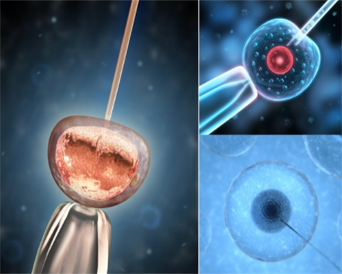 「鉴赏」钧窑最经典的10种器型