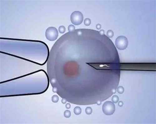 做试管选择医院重要吗_试管龙凤胎要多少钱_女性取卵需要做什么准备？取卵后