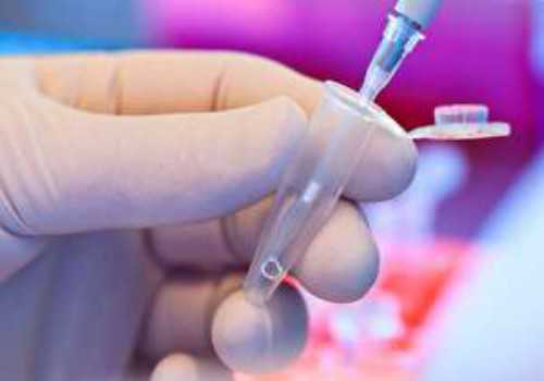 经期前后外阴瘙痒怎么治疗